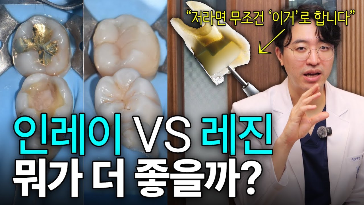 “요즘 최신 치료는 이겁니다” l 충치치료 받기 전 보고가세요