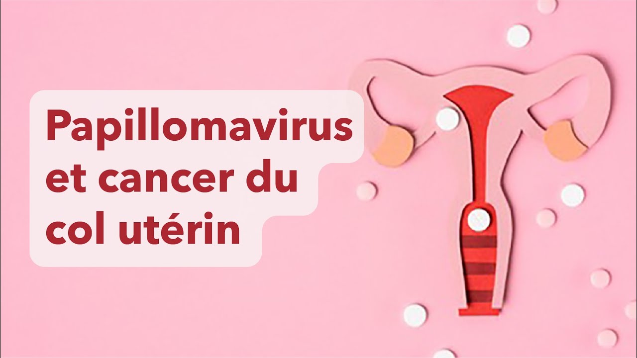 Papillomavirus et cancer du col de l'utérus : vaccin et prévention