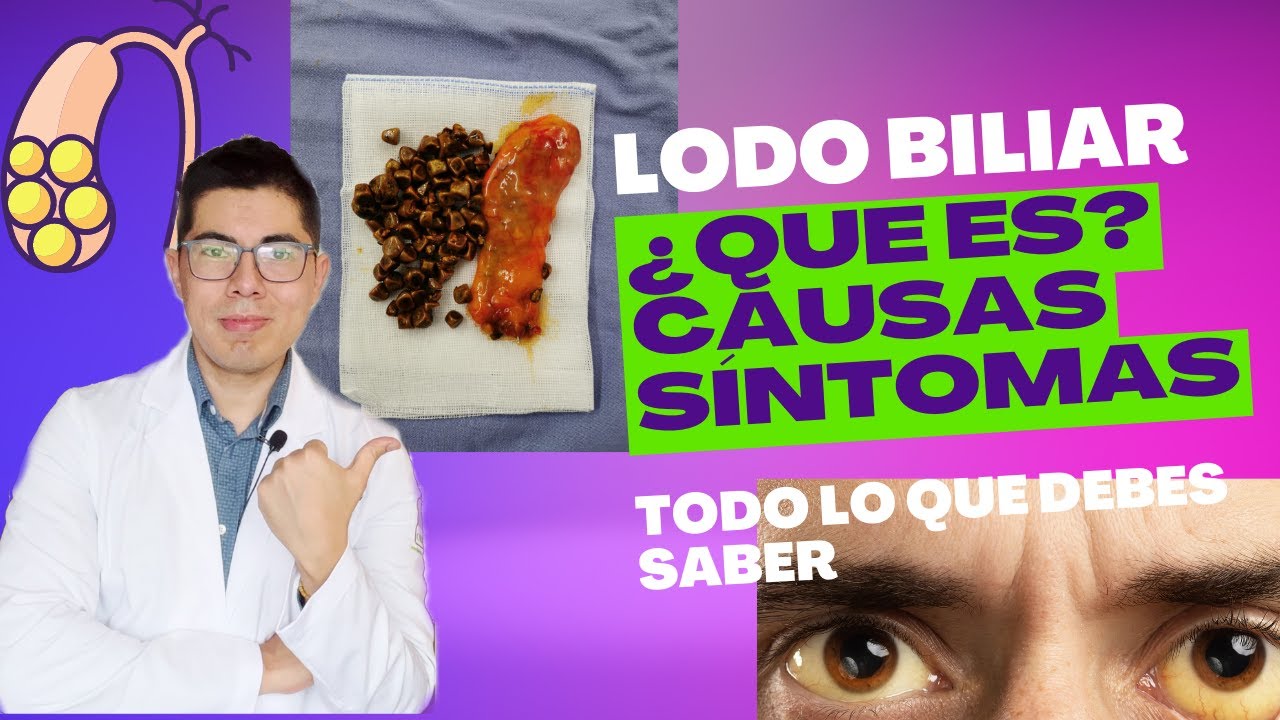 Lodo biliar: qué es, causas, síntomas, remedios, tratamiento