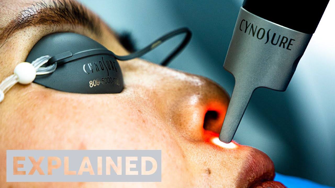 EXPLAINED: PicoSure Pro Laser | London