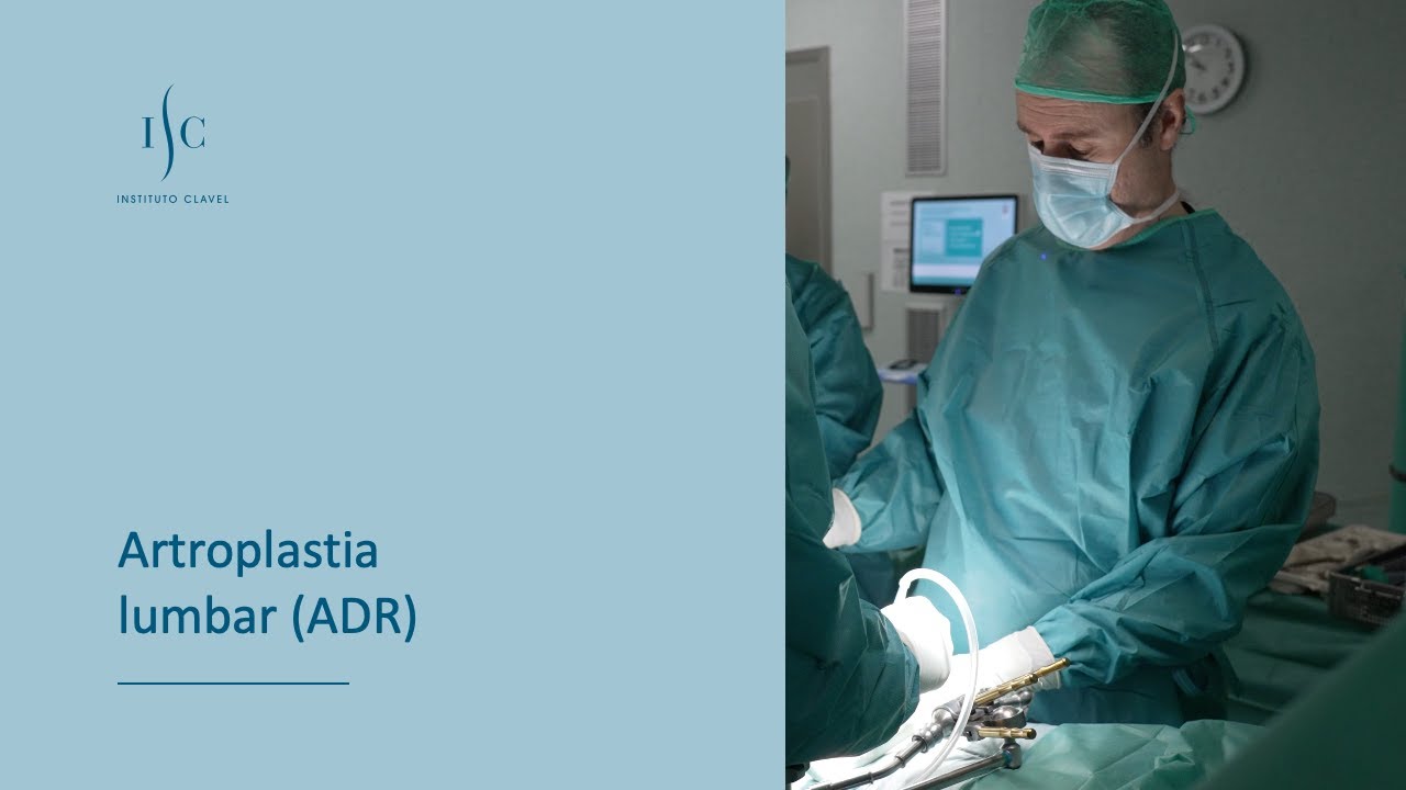 Artroplastia lumbar (ADR) | Instituto Clavel