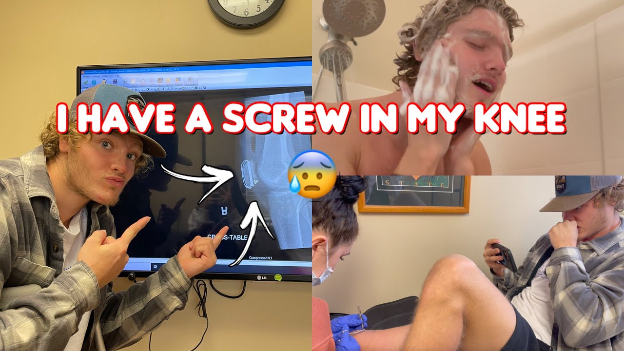 I TOOK MY FIRST SHOWER! #injury #brokenbones #update