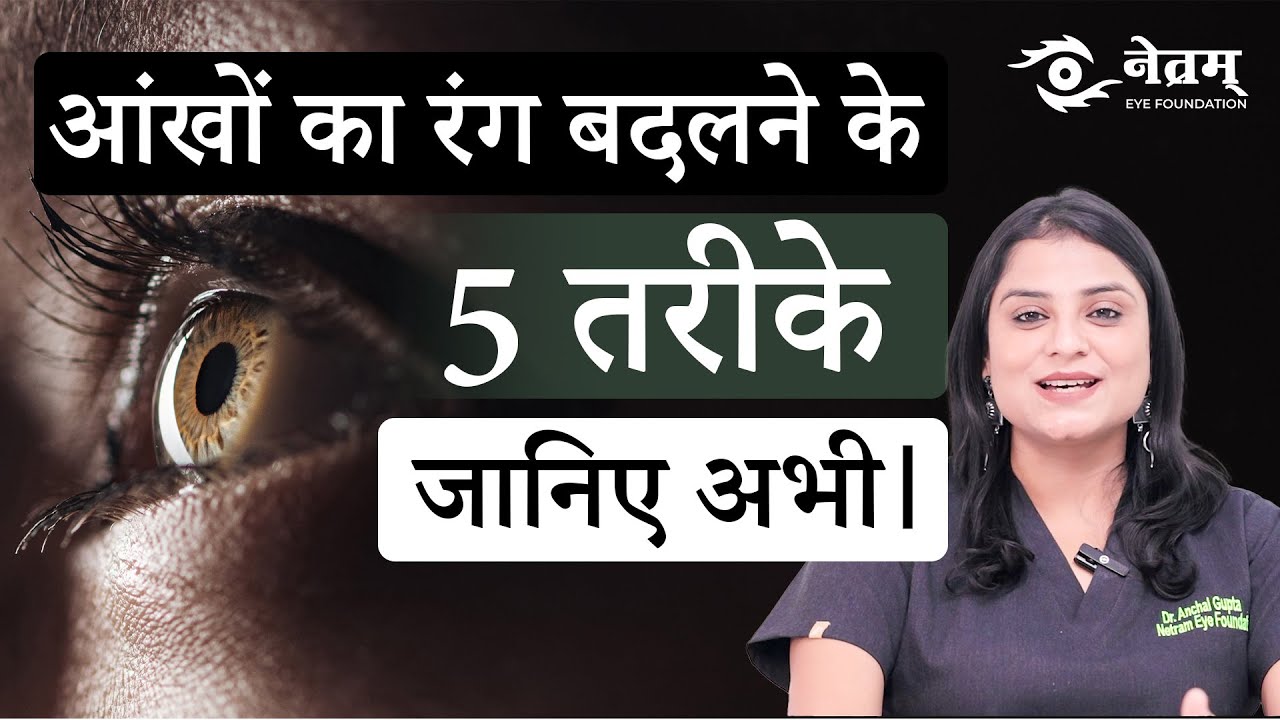 Ways to Change Eye Color | आंखों का रंग बदलने के 5 तरीके | Dr. Anchal Gupta | Netram Eye Centre