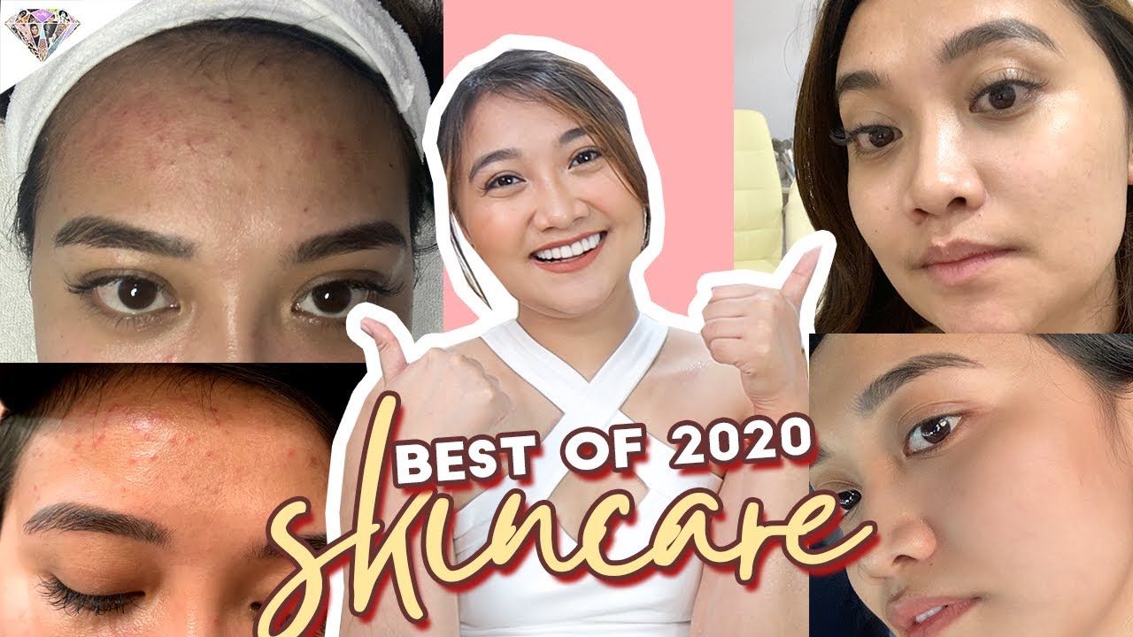PAANO NAWALA ANG TIGYAWAT KO? | HOW TO TREAT MASKNE? | BEST OF SKINCARE 2020 | MAE LAYUG