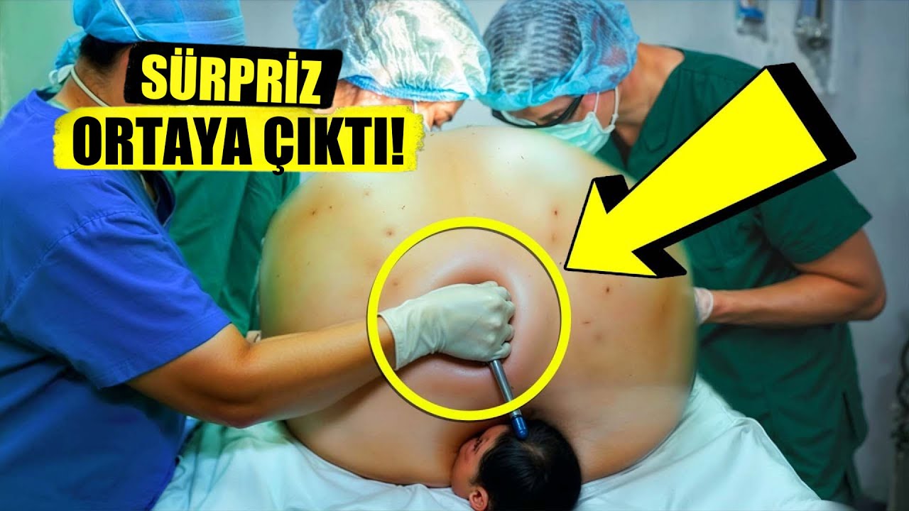 Hamile Anne Her Şeyi Bildiğini Sanıyordu! Ama Ultrasonda İnanılmaz Bir S&uuml;rpriz Ortaya &Ccedil;ıktı!