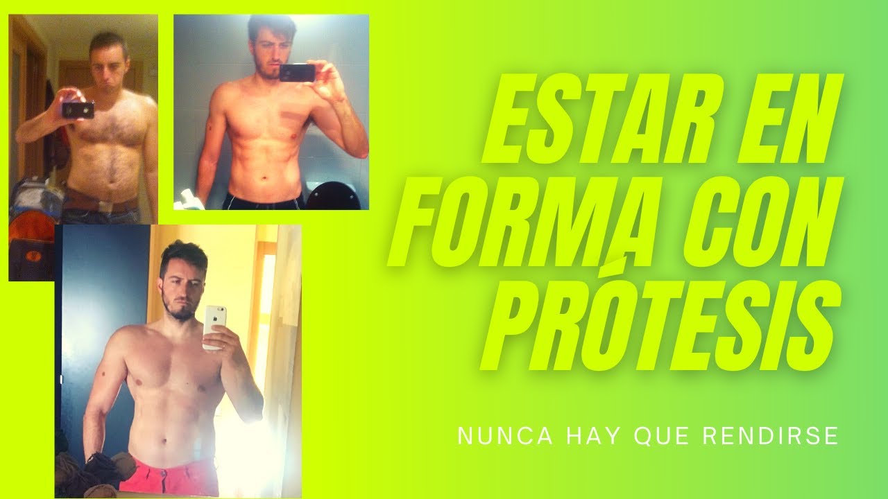 Deporte con prótesis de cadera, ¿es posible estar en forma?