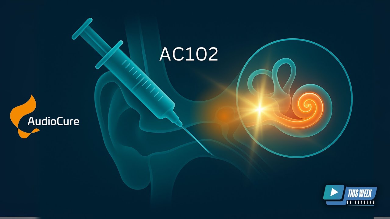 Regenerative Therapies for Sudden Hearing Loss: AC102 from AudioCure