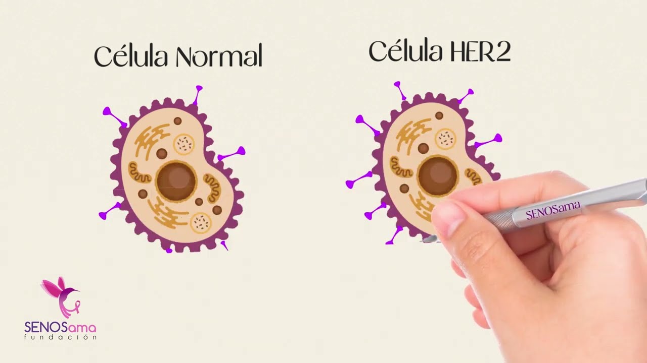 Video 5 - HER2 Positivo - Cáncer de mama