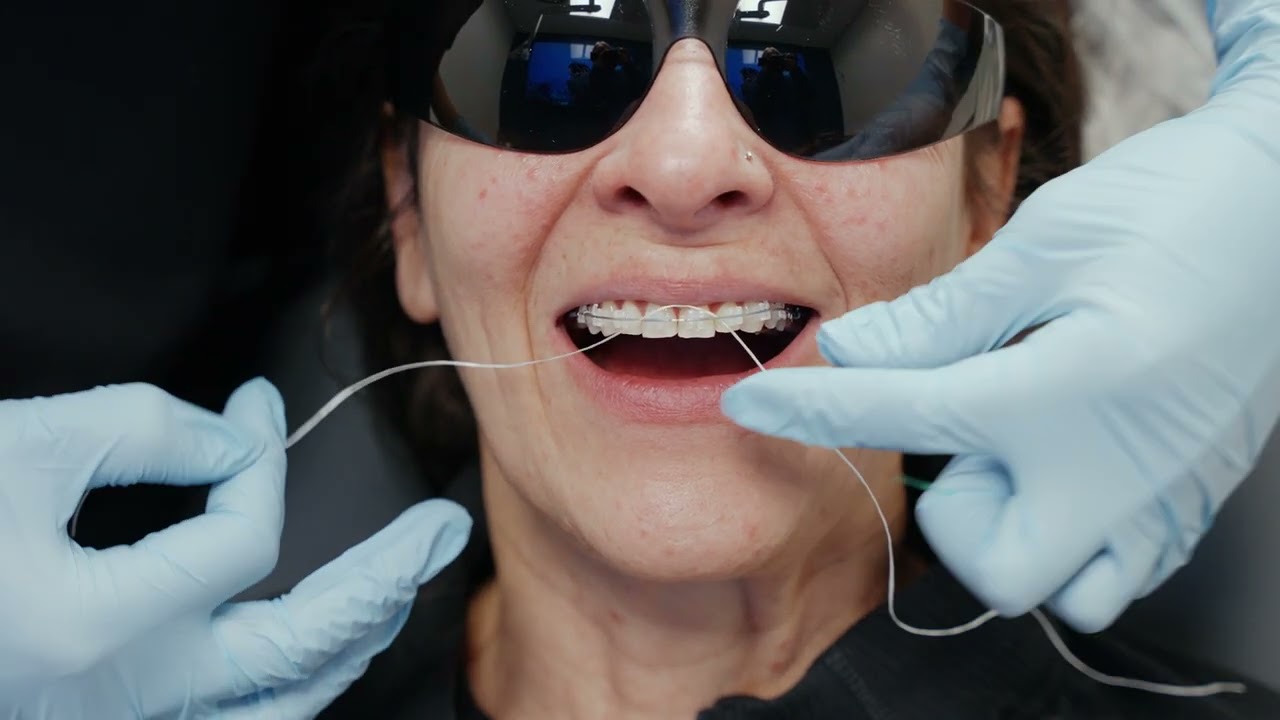 Metal Braces Aftercare: Post Operation | Oasis Dental