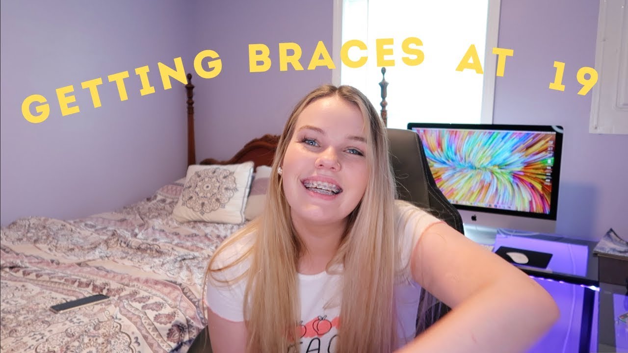 getting braces at 19