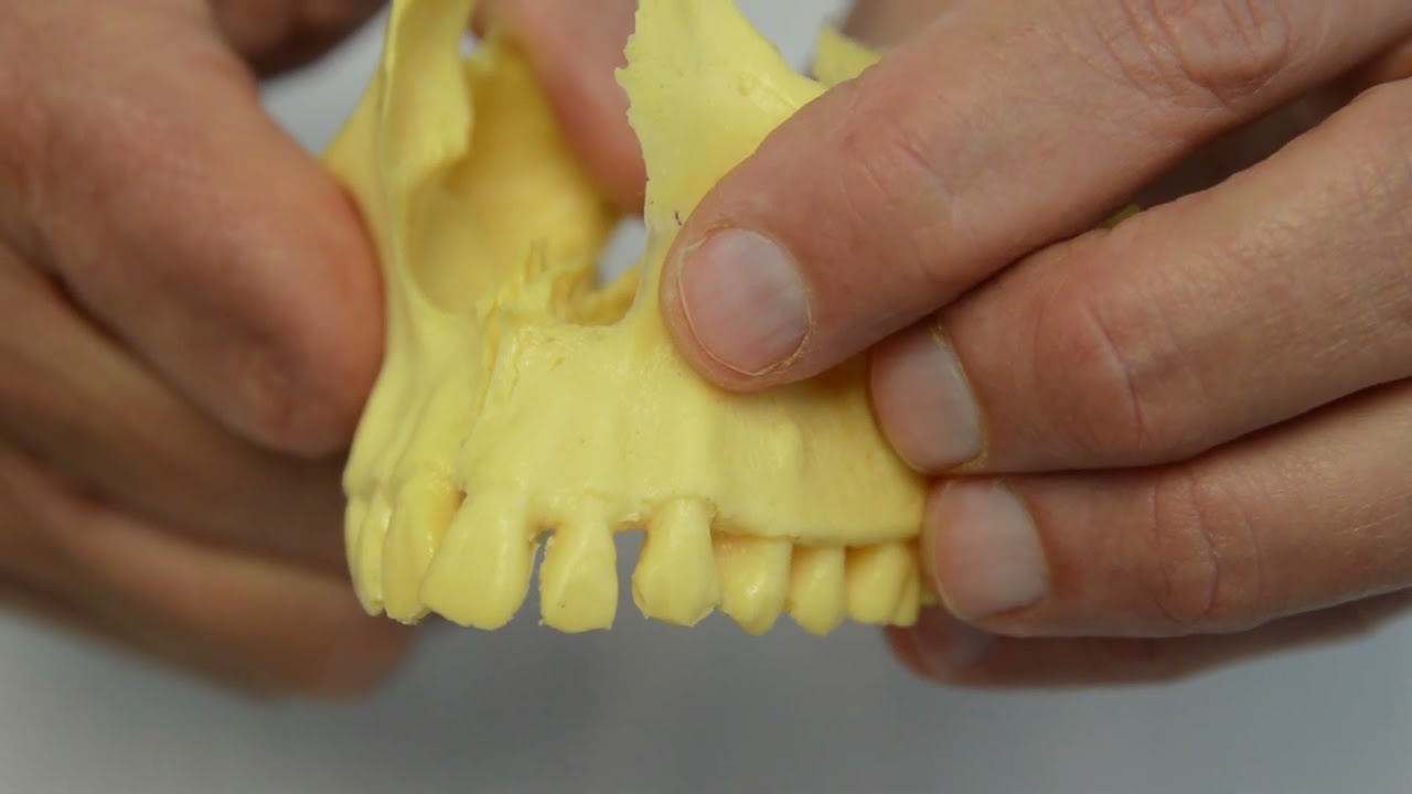 Maxilla Adjustment || Full HD