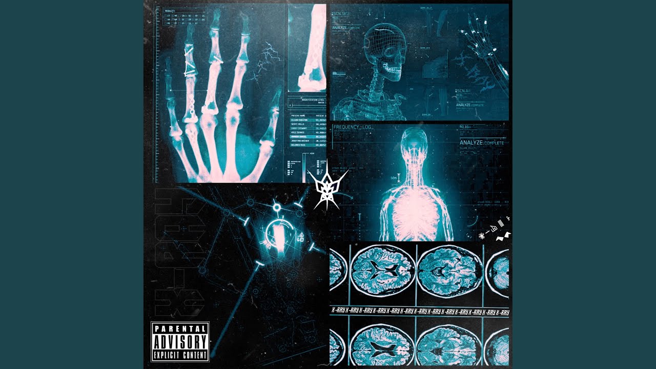 X-RAY