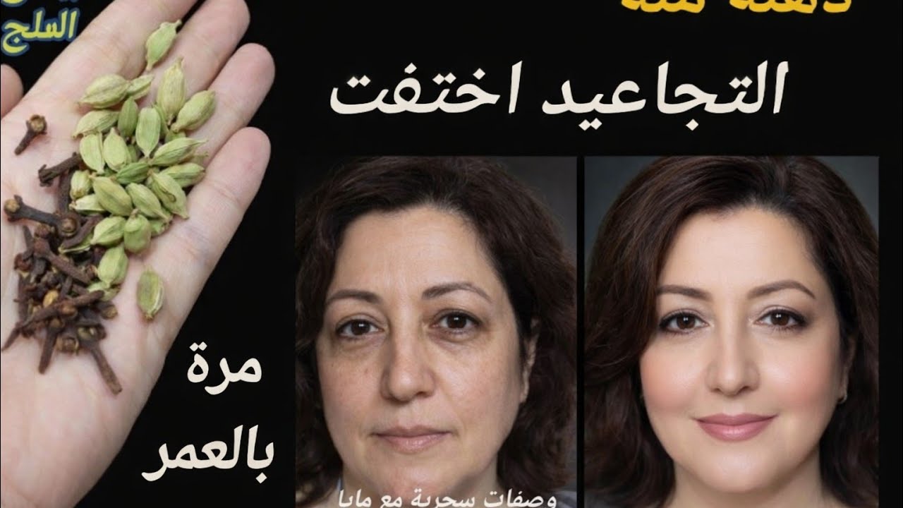 أنا مسؤولة عن كلامى, حتى لو عمرك 60سنة ضعيها على التجاعيد وستختفى فوراسيجعل وجهك ابيض مشدودكأنك شابة