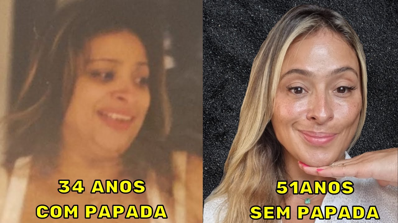 Acabe com a PAPADA, QUEIXO DUPLO e Reduza PELE FLÁCIDA no Pescoço! Vem ver como!