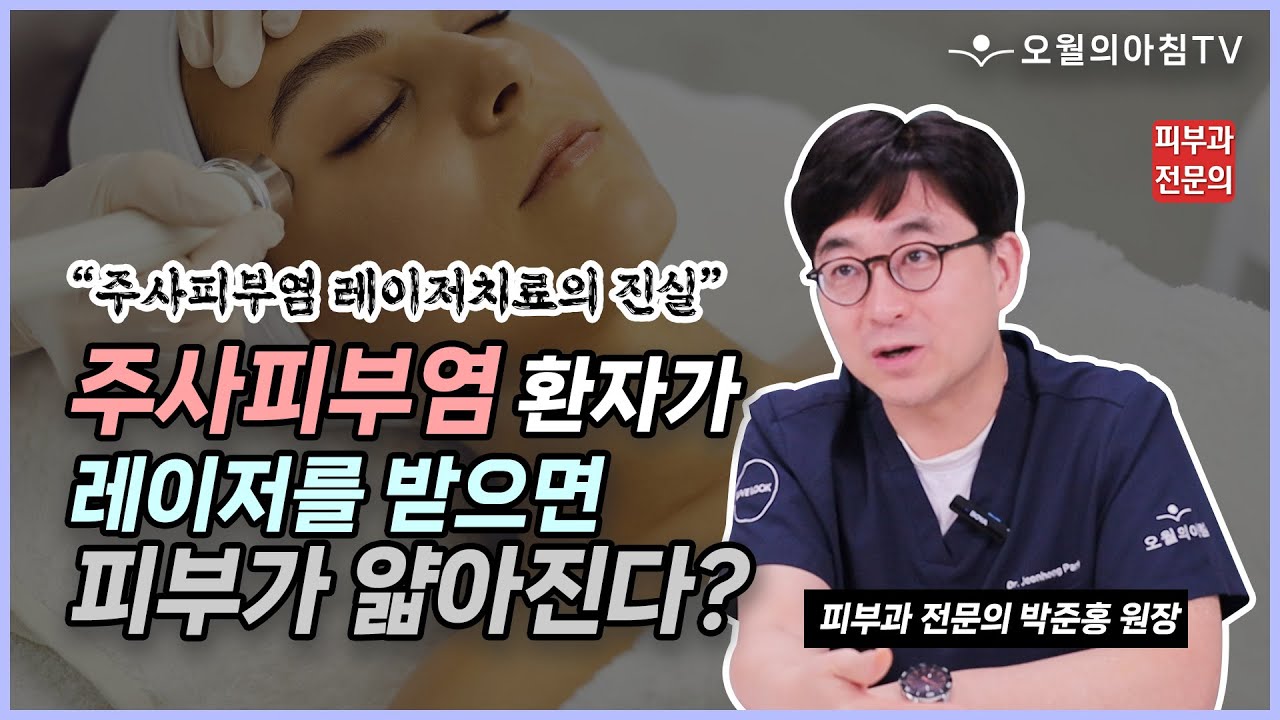 주사피부염, 레이저 하면 