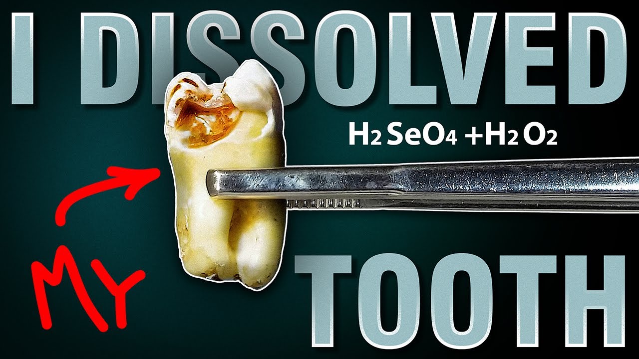 Я растворил свой зуб в SELENIC Piranha!