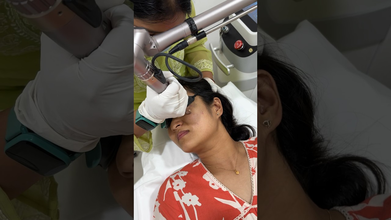 Birthmark removal using laser treatment