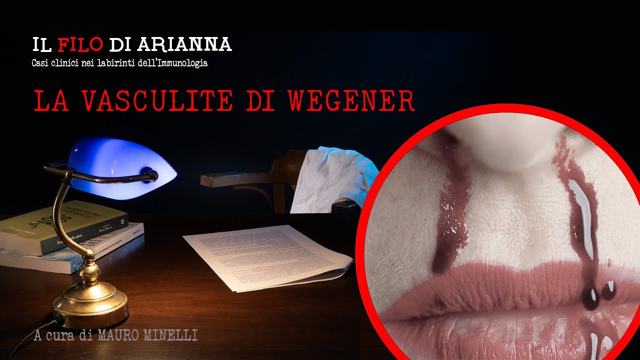 Il filo di Arianna: Vasculite di Wegener