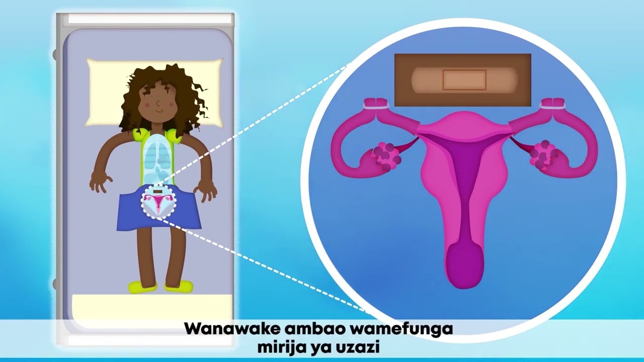 Tubal Ligation for Women | Permanent Contraception Method