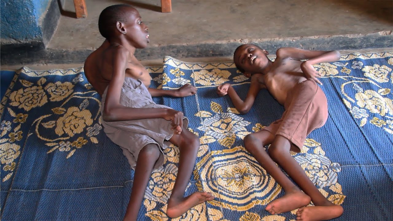 Umuryango Wose Uri kumagara Nkigiti | Burya bari bafite ubwenge budasanzwe | Twarize Twese Tubabonye