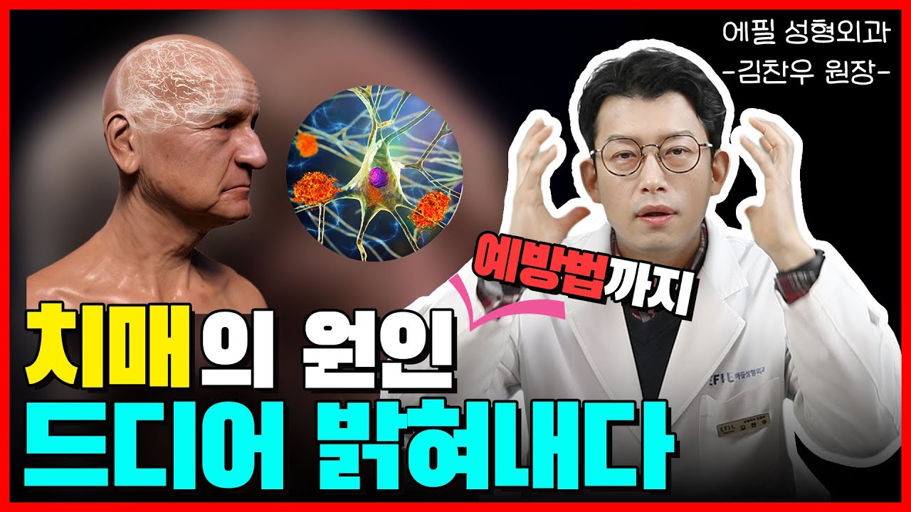 노인성 3대질환 치매! 치매의 원인과 치매 예방법 궁금하셨죠? 이 영상으로 확인하세요
