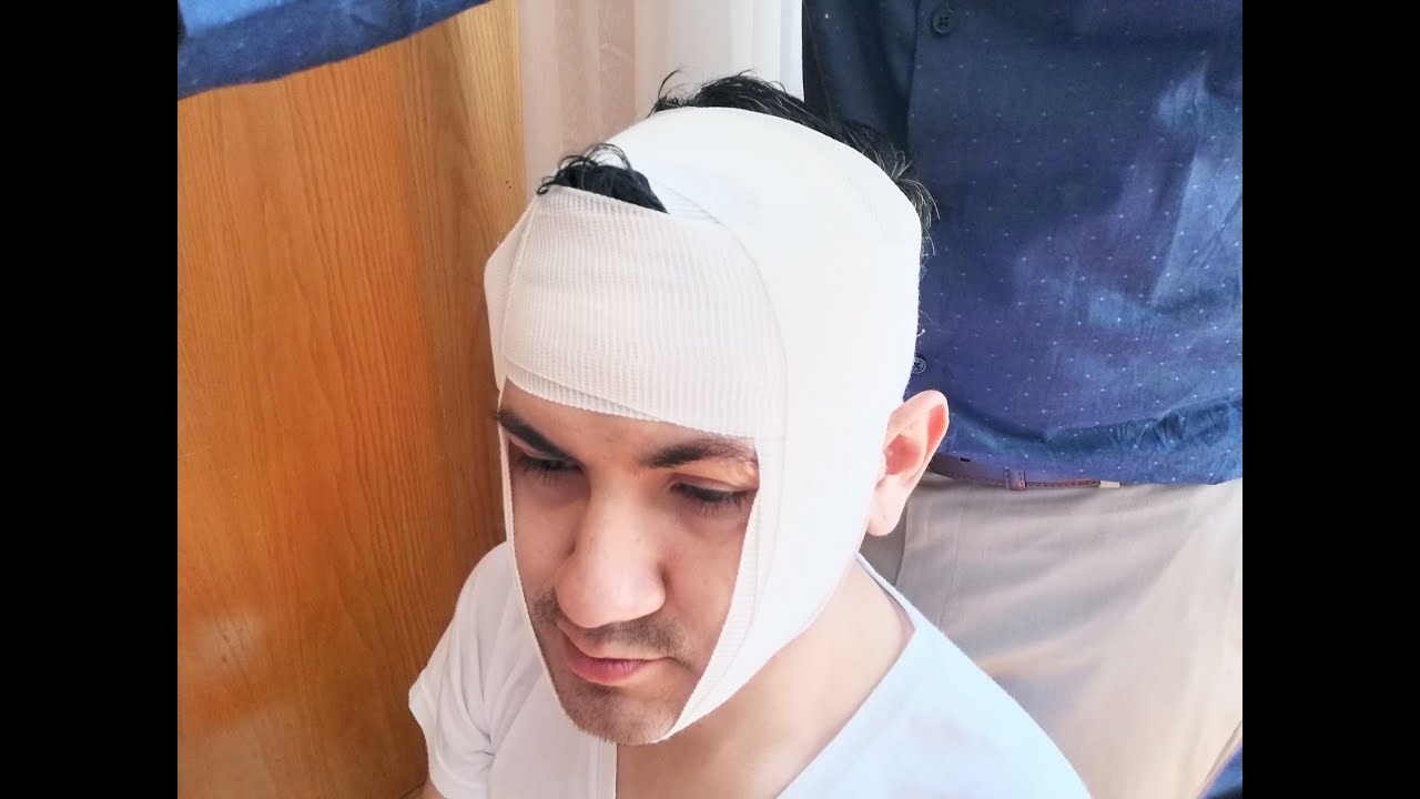 Cabeza - Vendaje oblicuo para soporte mandibular
