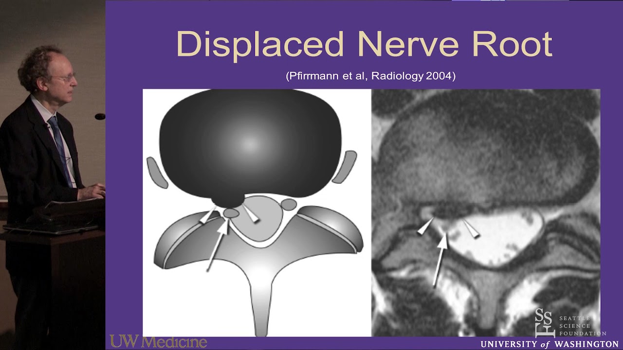 Lumbar MRI:  What the Findings Mean and How They Should Be Reported - J. Jarvik, MD, MPH