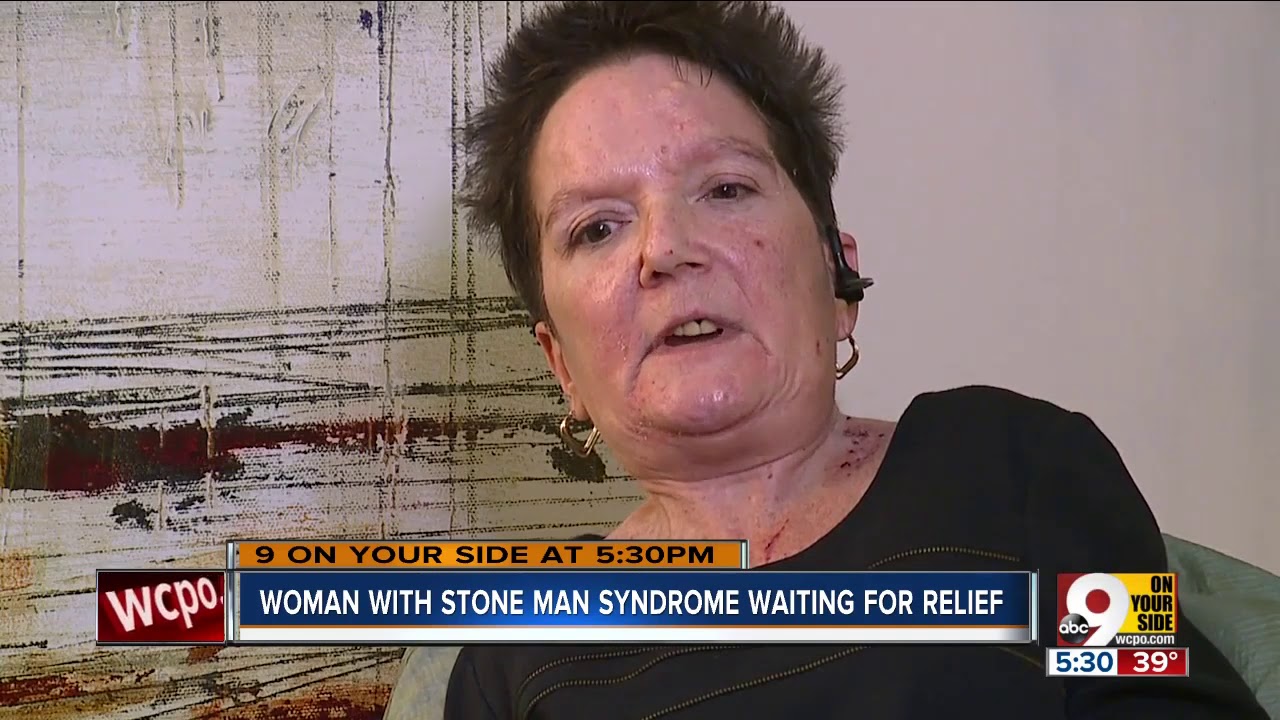 Woman with 'stone man syndrome' still waiting for relief