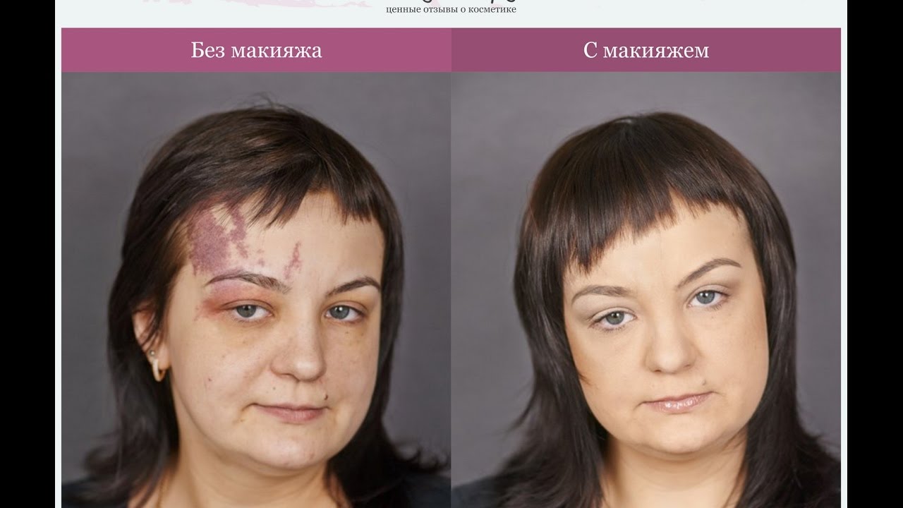 Как скрыть пигментное пятно с помощью макияжа?