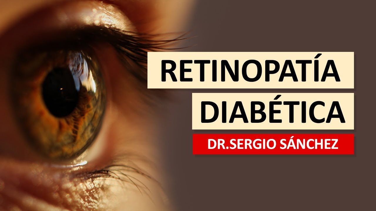 Clínica La Luz TV - Retinopatía Diabética, que es? como tratarlo?