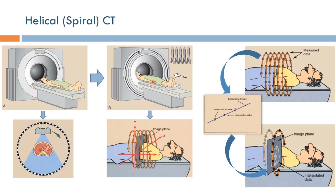 Short Topics in Computed Tomography: Spiral CT (Arabic Narration)
