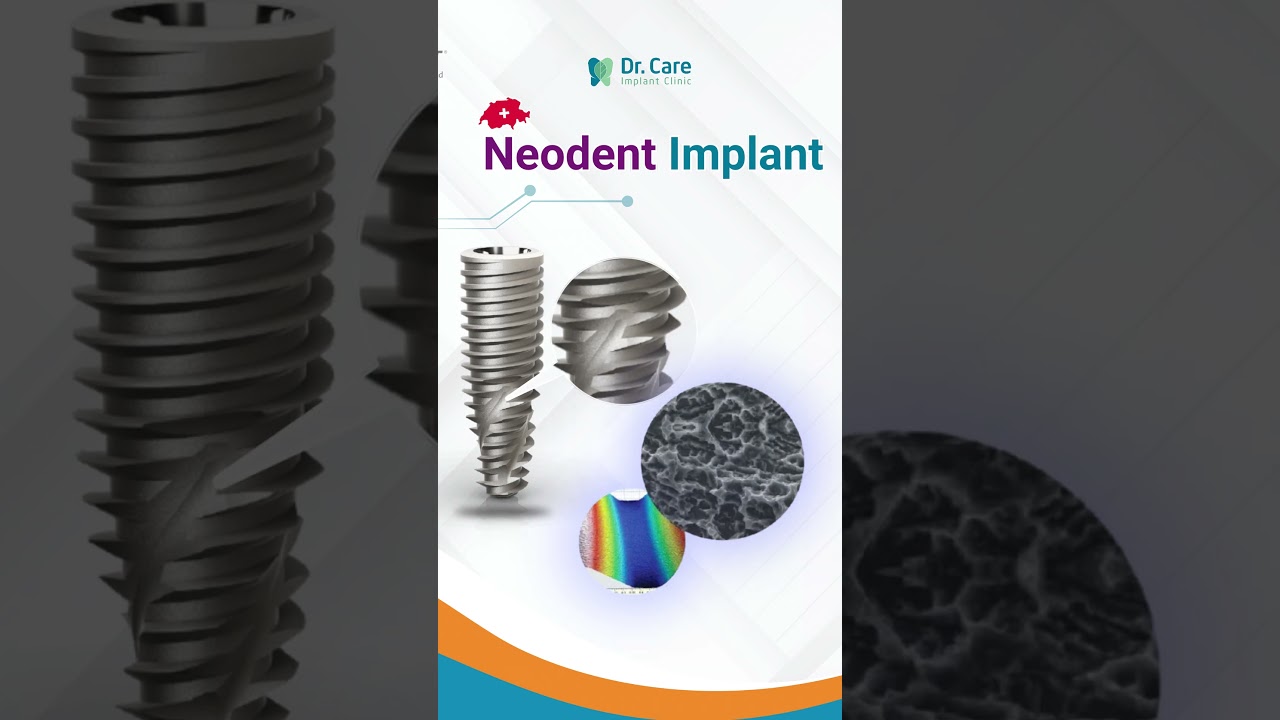 THẤT BẠI 80% KHI TRỒNG IMPLANT NẾU KH&Ocirc;NG CHỌN Đ&Uacute;NG D&Ograve;NG TRỤ PH&Ugrave; HỢP!