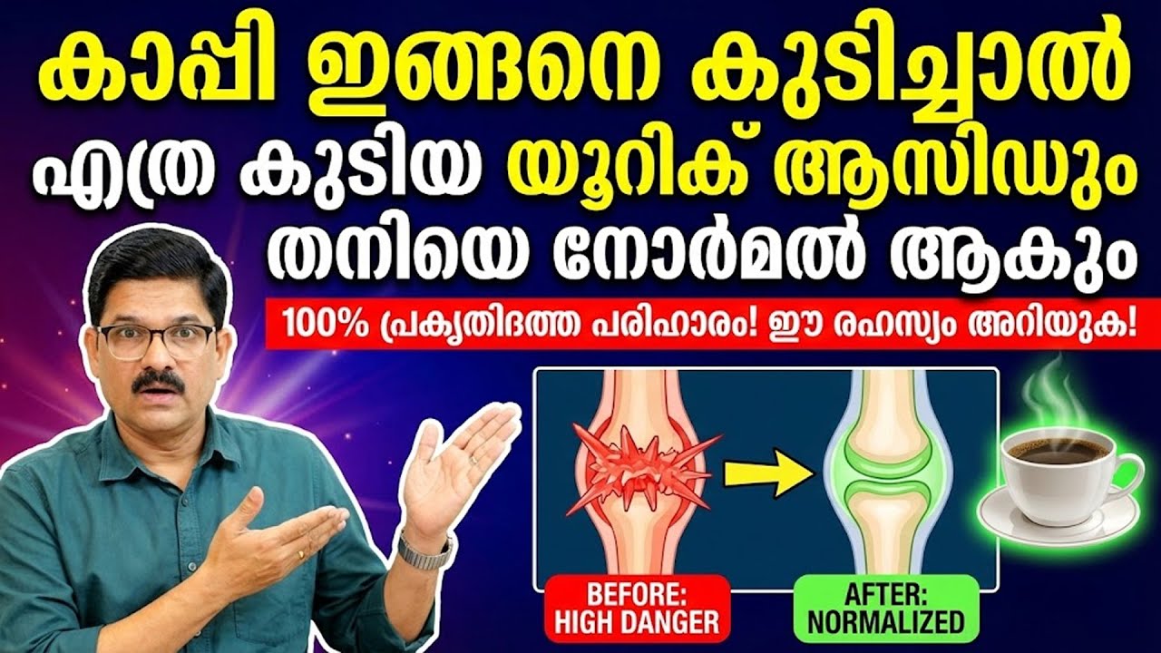 കാപ്പി ഇങ്ങനെ കുടിച്ചാൽ എത്ര കൂടിയ യൂറിക് ആസിഡും തനിയെ നോർമൽ ആകും