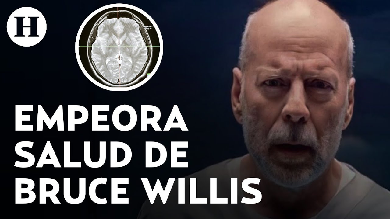 ¿Qué es la demencia frontotemporal? Enfermedad progresiva que afecta la salud de Bruce Willis
