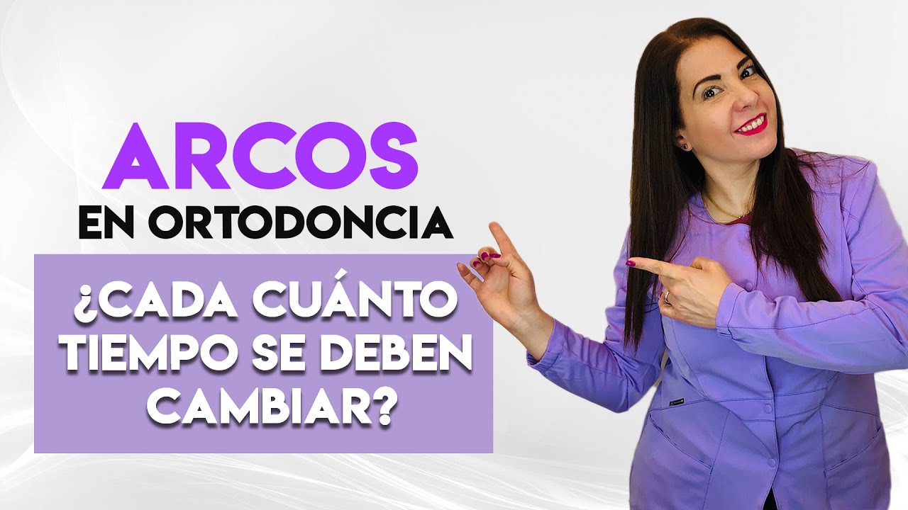 Arcos en Ortodoncia, ¿Cada cuánto tiempo se deben cambiar?