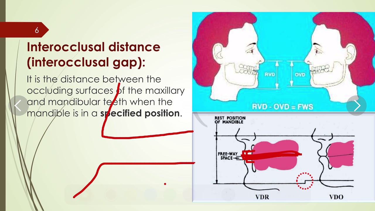 2-08 prosthodontics, Vertical relation.
