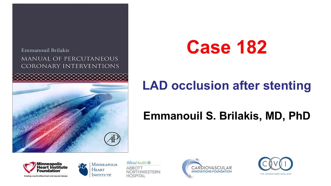 Case 182: Manual of PCI - LAD occlusion after stenting