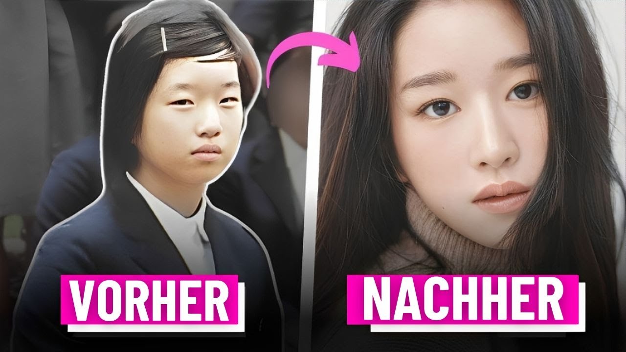 Die 5 BIZARRSTEN Schönheitsoperationen koreanischer Stars!