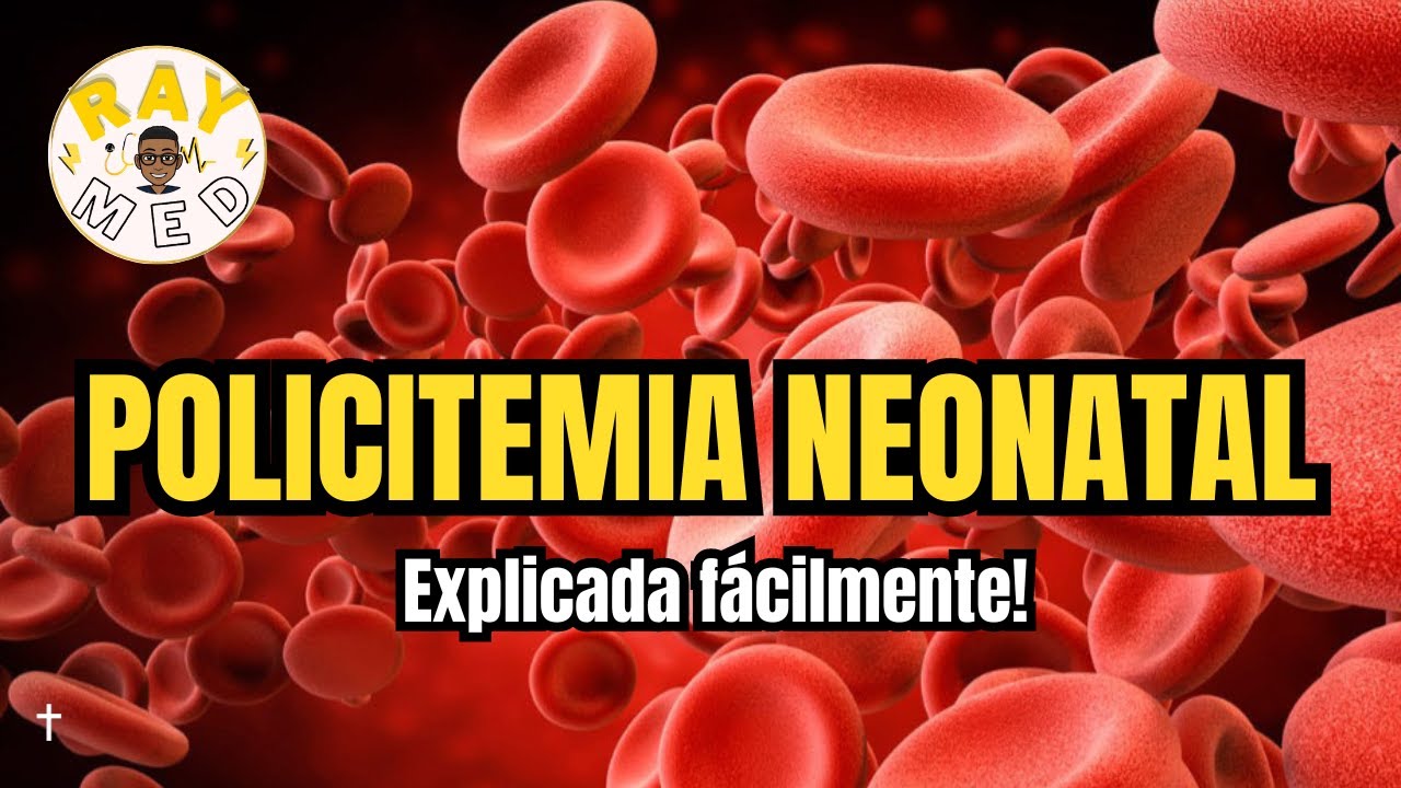 POLICITEMIA NEONATAL - NEONATOLOG&Iacute;A
