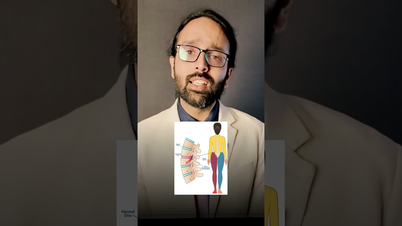 Tips To Keep Your Spine Healthy By Spine Specialist - Dr Devashish Sharma