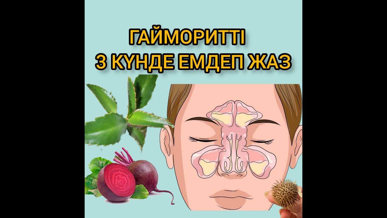Гайморитті ҮЙ ЖАҒДАЙЫНДА емдеу. Гаймориттің белгілері.
