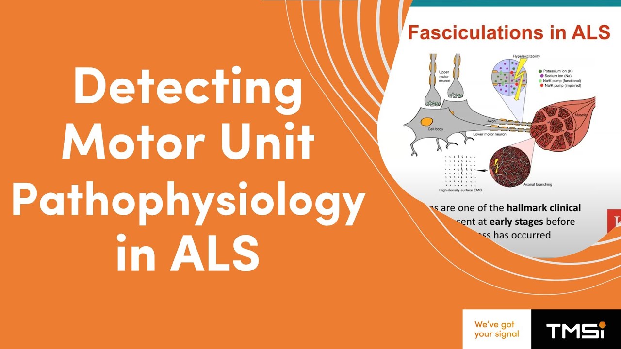 Expert Talk: Detecting Motor Unit Pathophysiology in ALS