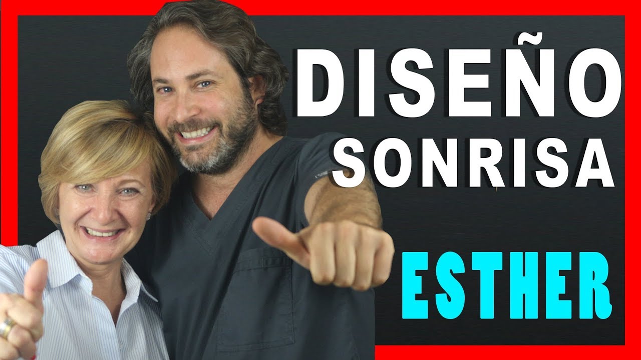 🔥CORONAS dentales dientes DELANTEROS - Diseño de SONRISA en Madrid 👉Esther👈