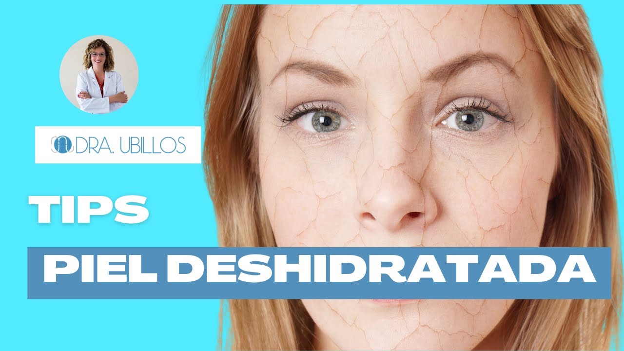 TIPS PARA PIEL DESHIDRATADA | PIEL CON MANCHAS