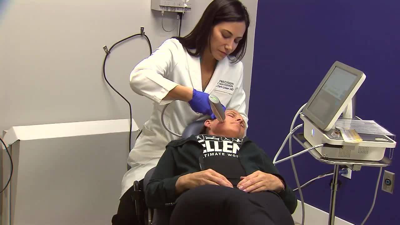 Sublime, Sublative devices help tighten skins without going under the knife