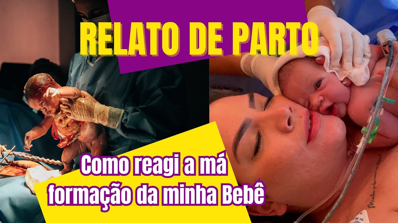 RELATO DE PARTO - FOI HUMANIZADO? COMO REAGI A MÁ FORMAÇÃO DA MÃO DA MINHA BEBÊ