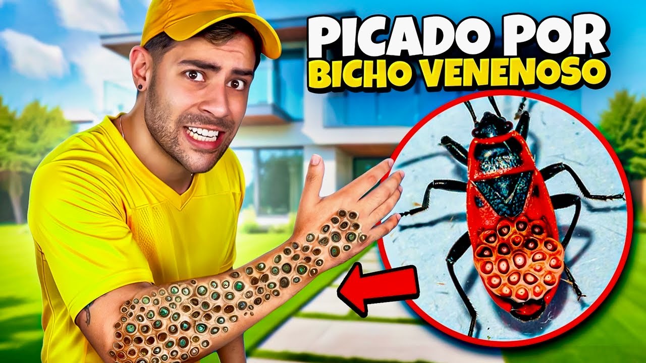 FUI PICADO POR UM BICHO MUITO VENENOSO! *fui pro hospital ?