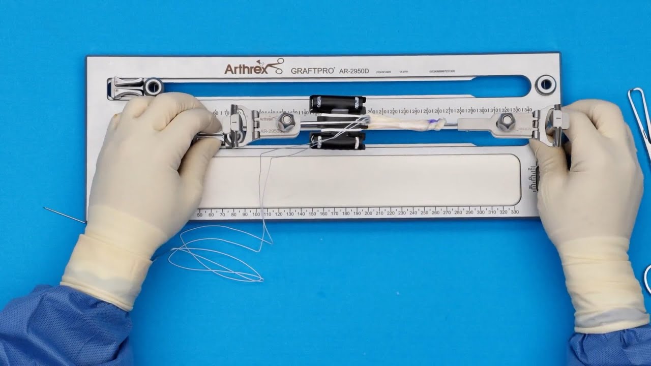 Quad Tendon Graft Preparation Using Sliding GraftClamp Instruments
