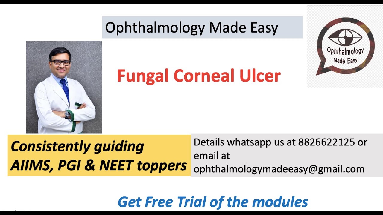 Fungal Corneal Ulcer