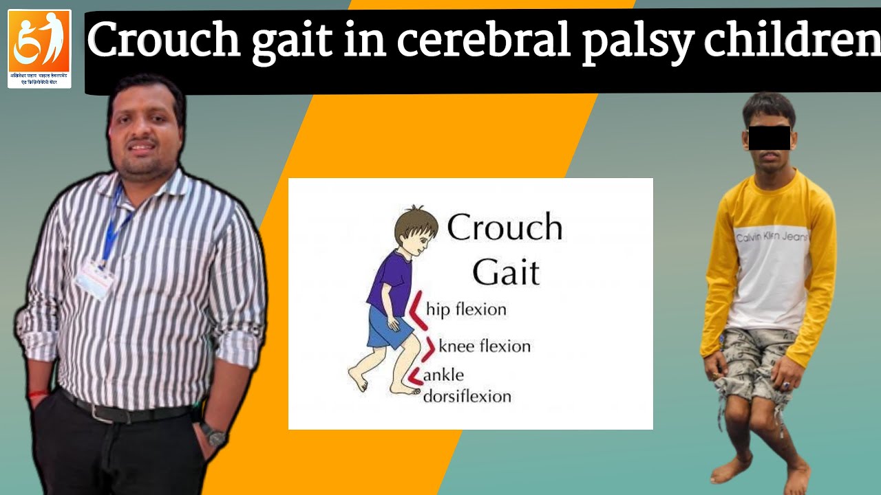 crouch gait in cerebral palsy children ! crouch gait causes and treatment ! crouch gait exercises